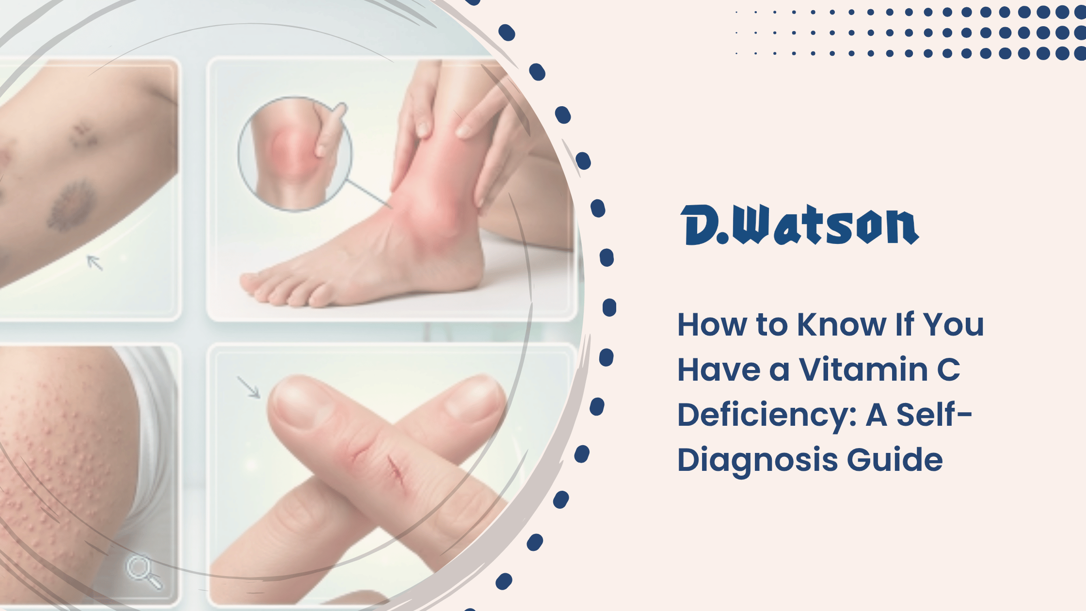How to Know If You Have a Vitamin C Deficiency: A Self-Diagnosis Guide