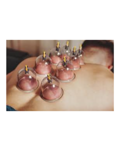 Cupping_Therapy_1769172494.png