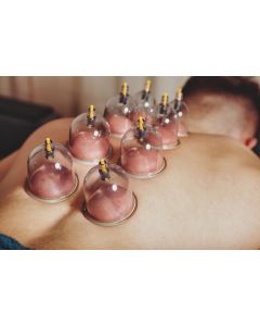 Cupping_therapy.jpg